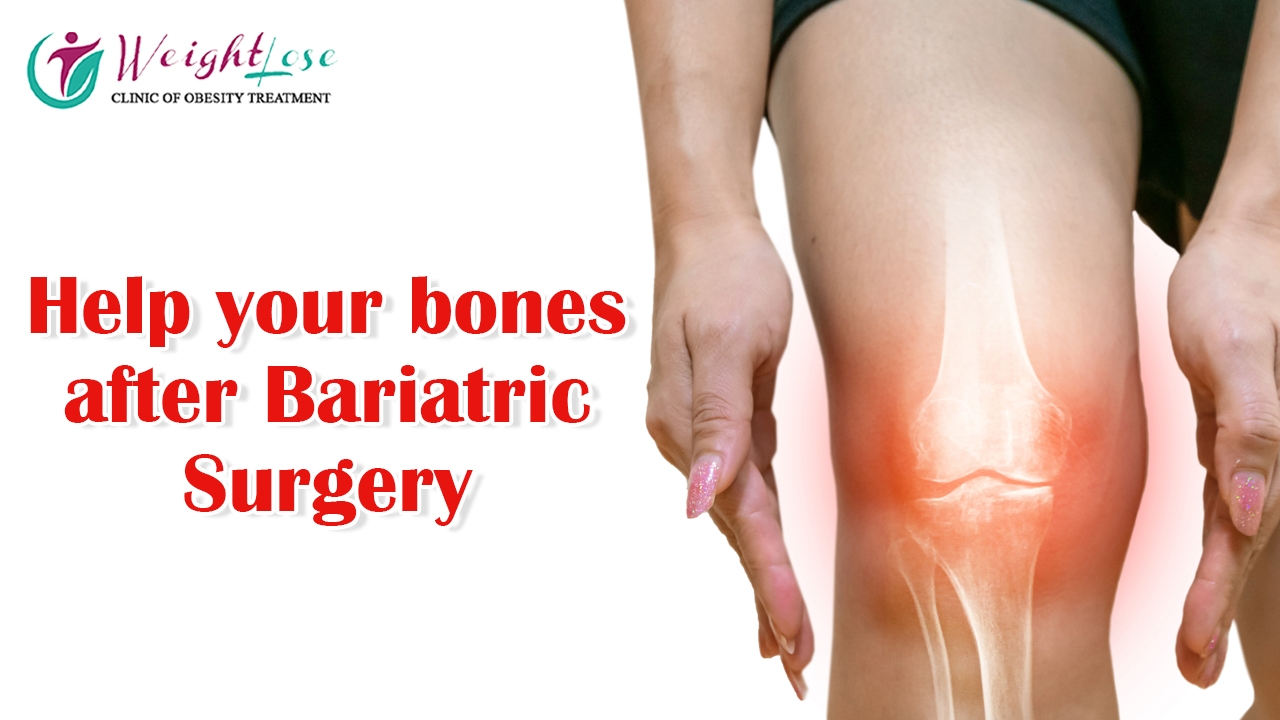 Help your bones after Bariatric Surgery